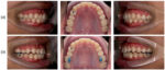 Anabond Blu-Bite - Image 3