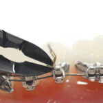 GDC Orthodontics Black Line Cutter - Pin Ligature (3200/708) - Image 3