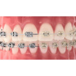 U ortho ligature Ties -Assorted - Image 5