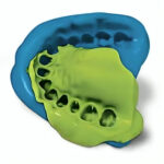 Neoendo Neopure Hydrophilic A-Silicon Putty + Light Body Kit (Fast Set) - Image 3
