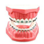 OSL Orthodontic Intraoral Elastics - Image 3