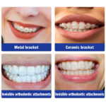 Prime Dental Restorite OrthoGrip Light Cure Orthodontic Adhesive Kit - Image 4