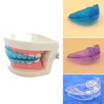 U Ortho Retainers - Image 5