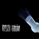 Woodpecker Ai Ray Portable X-Ray Machine - Image 6
