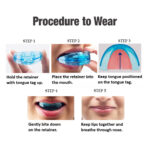 U Ortho Retainers - Image 4