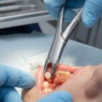 GDC American Forcep Pedo Universal Lower Primary Teeth & Roots # 151S (F151S) - Image 6