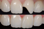 SafeEndo ReCreate LC Flow - Image 8