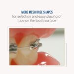 UU Ortho Premium Bondable Buccal Tubes MBT (Pack of 20 Sets) - Image 23