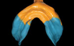 Waldent Edentulous Perforated Impression Trays Set K18/1 - Image 7