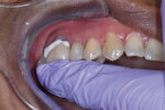 Prevest Oratemp Ne Manual-Mix - Image 9
