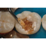 GDC Spoon Excavator Oval Shape #3 EXC31L - Image 4