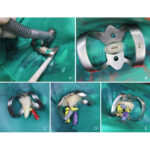 Coltene Hysolate Fiesta Color Coded Dental Dam Clamps Kit and Refills - Image 6