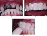 Prevest Fusion Ultra D/C- Intro Pack - Image 6