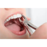 GDC Extraction Forceps Upper Roots Narrow - 29n Standard (Fx29ns) - Image 5