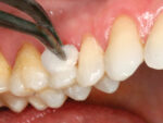 Prevest Copal F - Image 6