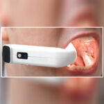 Waldent Maxbite Intraoral Lighting - Image 17