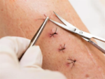 API Surgical Scissors Premium - Image 4