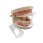 Dental Anterior Mouth Prop | Transparent - Image 5