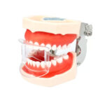 Dental Anterior Mouth Prop | Transparent - Image 3