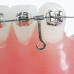 Koden Crimpable J Hooks (Pack of 10) - Image 3