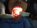 Waldent Maxbite Intraoral Lighting - Image 22