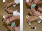 GI Dental Film Developing Clip - Image 5