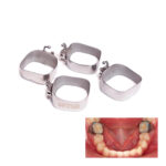 OSL 1st Molar Prewelded Molar Bands MBT 0.018 U2/L1 (Pack Of 4) - Image 2