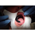 Waldent Maxbite Intraoral Lighting - Image 19
