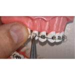 JJ Ortho NiTi Open Coil Spring 180mm (60.01.17) - Image 4