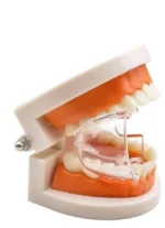 Dental Posterior Mouth Prop | Transparent - Image 3