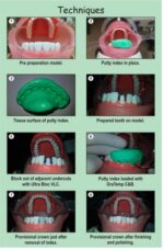 Prevest Denpro Oratemp C&B - Image 6