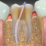 SafeEndo BioActive RCS - Image 4