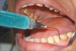 SafeEndo Hexachlor 500ml - Image 3