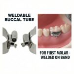 U Ortho Weldable Buccal Tubes -1st Molar MBT 0.022 - Image 4