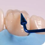 Waldent Plasma+ Composite Instrument Kit of 6 (K14/2) - Image 6