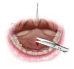 Waldent Oral Surgical Instruments Kit of 10 (K9/1) - Image 5