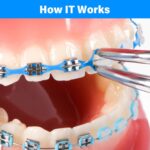 U Ortho E-Chain (15 ft) - Image 5