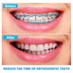 U Ortho E-Chain (15 ft) - Image 7